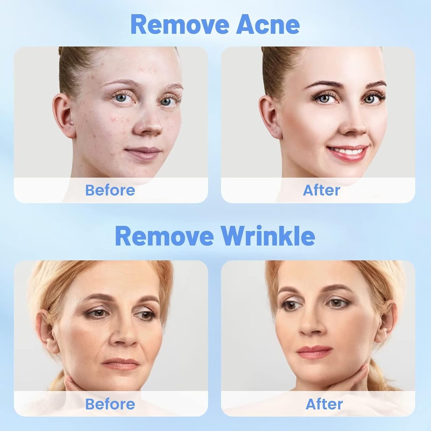 5 in 1 Micro Diamondermabrasion Machine, Mcwdoit Facial Machine 68cmhg Professional Home Use Skin Care - Image 7